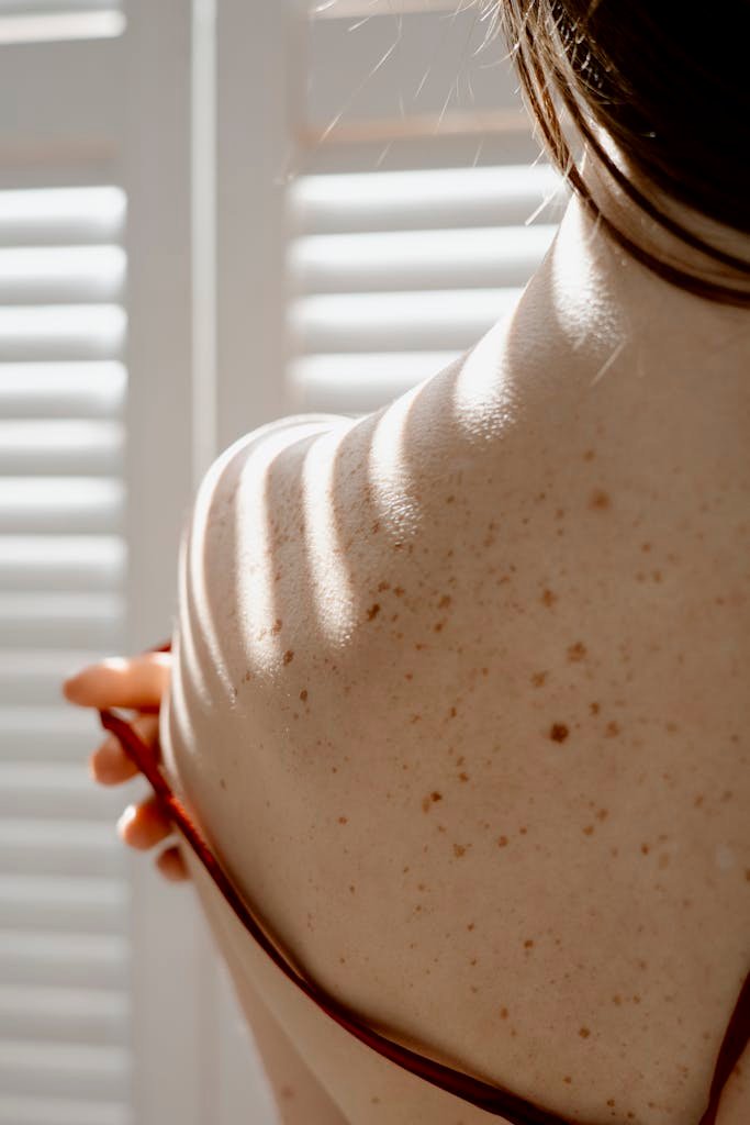 An artistic close-up of a freckled back with sunlight shadows creating patterns.