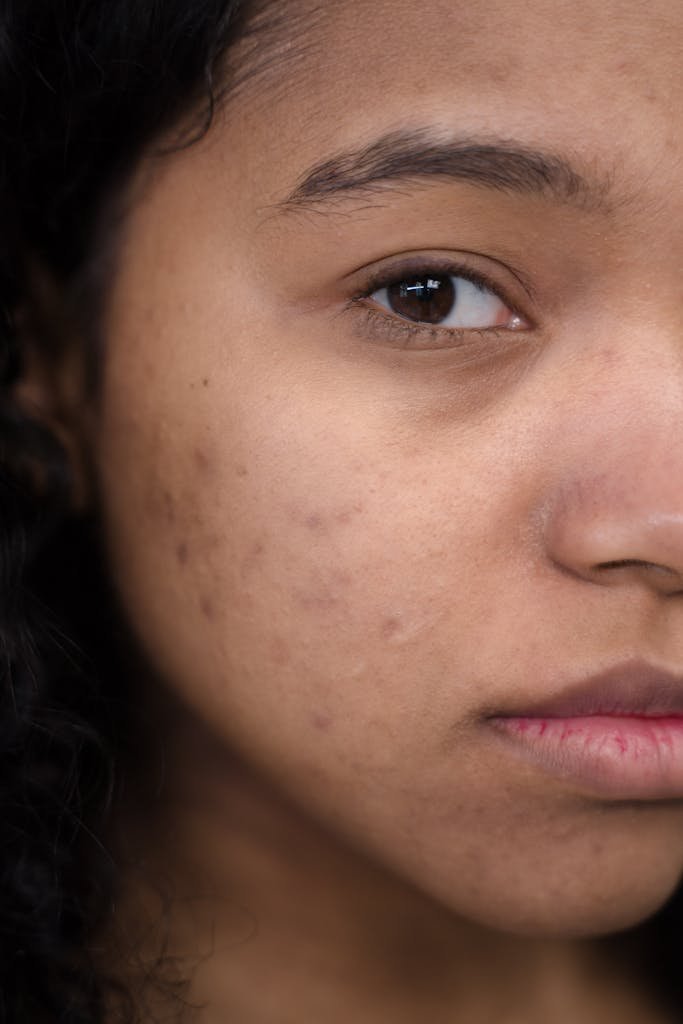 Close-up shot focusing on natural skin and acne scars, showcasing authenticity and real beauty.