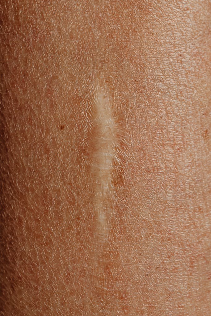 Detailed close-up image of a skin scar, highlighting texture and healing.