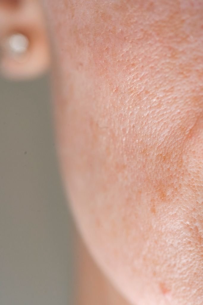 Detailed close-up of human skin showing natural pores and texture, highlighting real beauty.